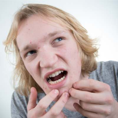 Build a Healthy Skin Care Routine For Acne Prone Skin